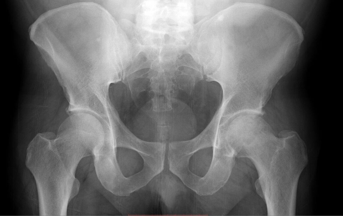 hip joint diagnosis