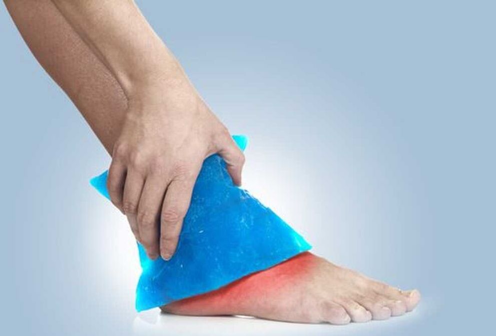 cold soak for ankle osteoarthritis