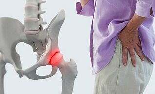 causes of arthrosis of the hip joint