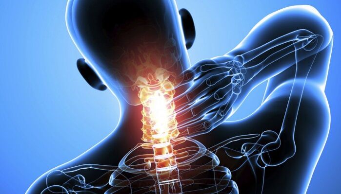 cervical spine pain