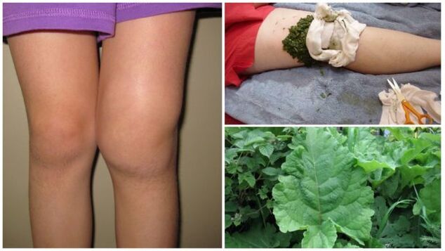 herbal compress for knee osteoarthritis